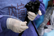 全国肿瘤防治宣传周丨做好一种检查，预防筛查三种消化道肿瘤